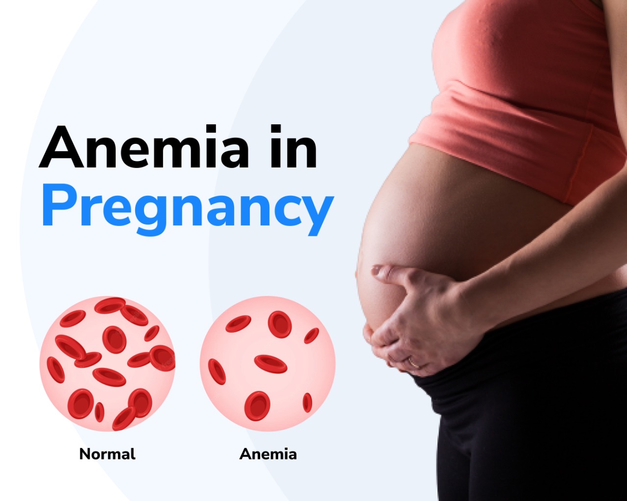 Pregnancy Anemia: Impact, Types, and Solutions